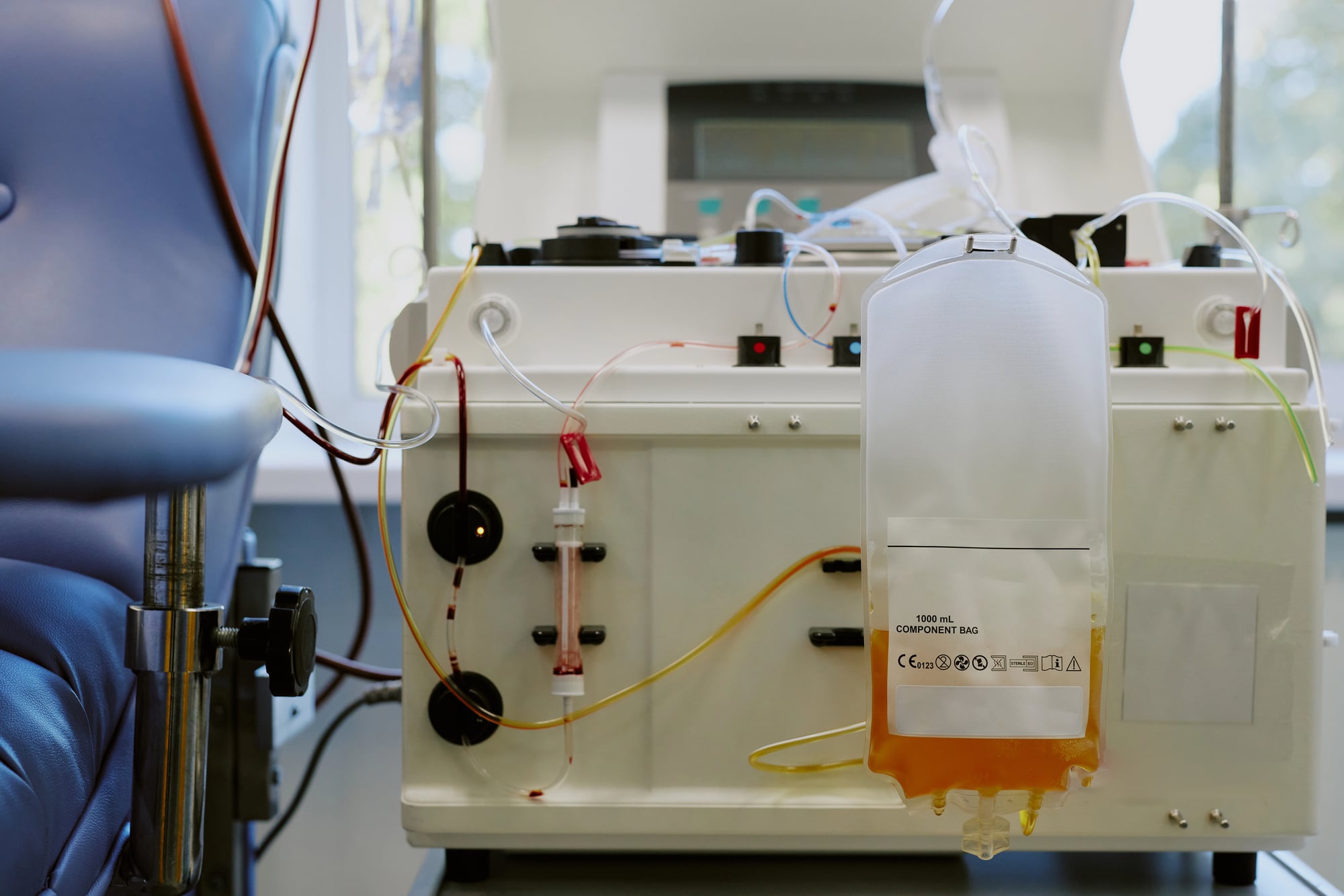 Equipamento de separação de componentes do sangue. A bolsa coletora contém plasma sanguíneo (fluido amarelo).