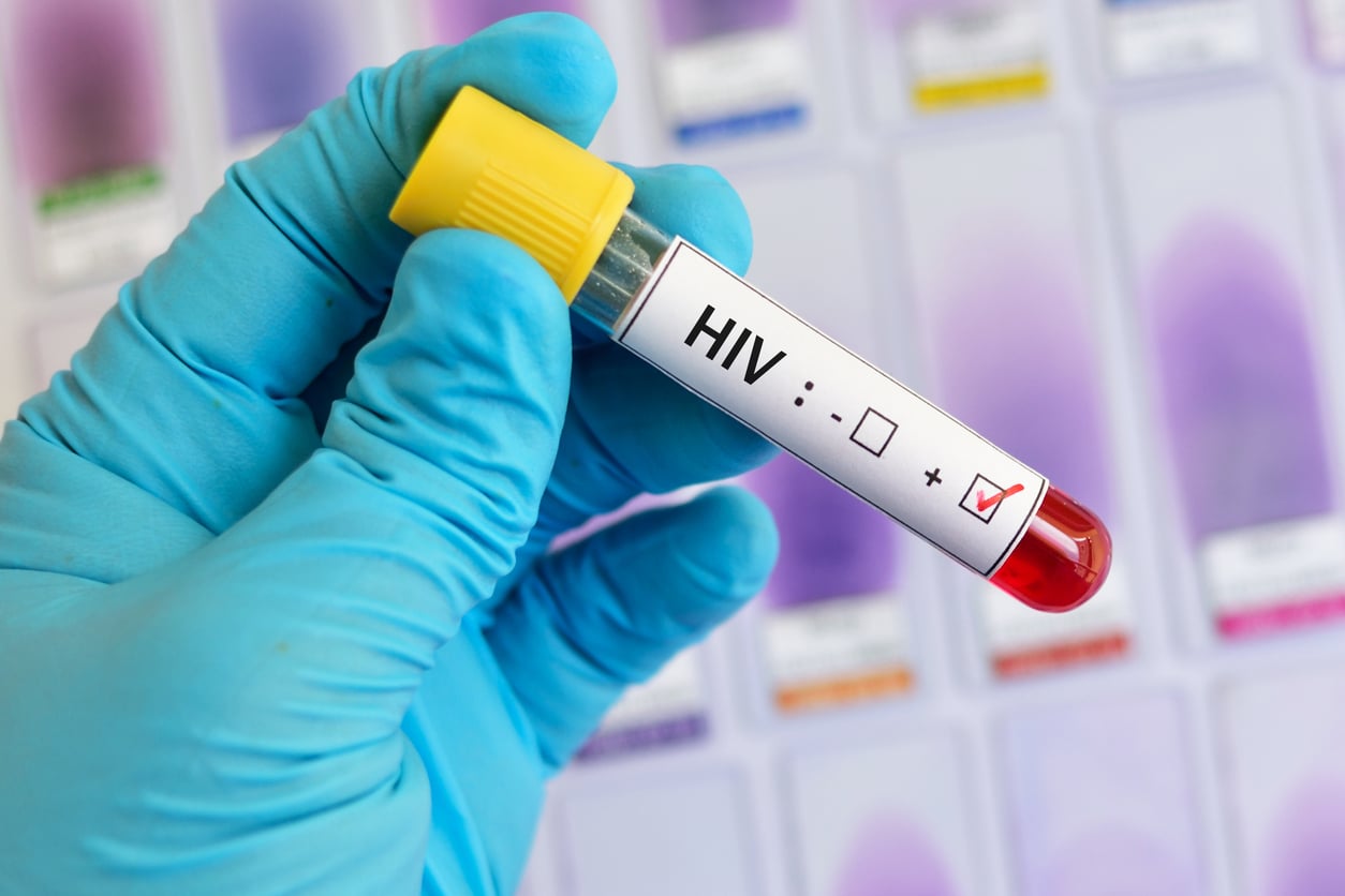 Novo estudo traz avanço promissor na busca pela cura do HIV