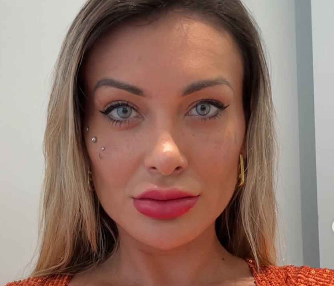 Após cirurgia definitiva nos olhos realizada na França, Andressa Urach enfrenta complicações no pós-operatório.