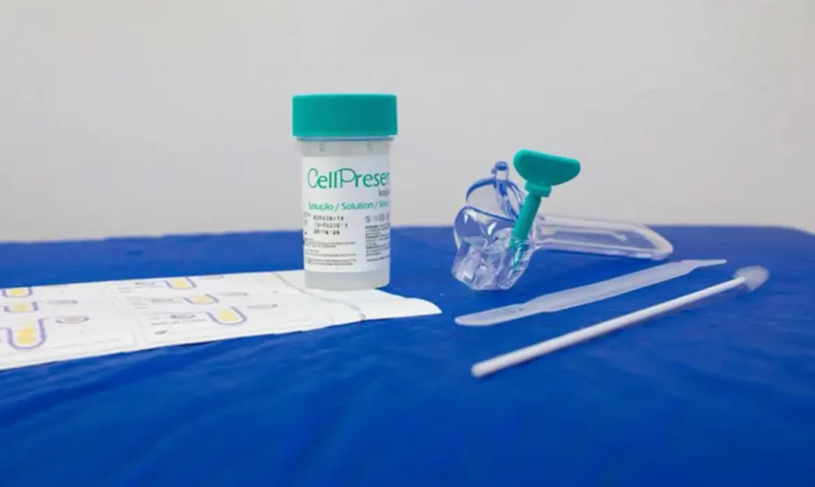 A coleta é similar à do papanicolau e envolve a secreção do colo do útero