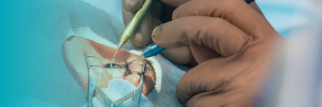 Facectomia- Foto: Médicos de Olhos