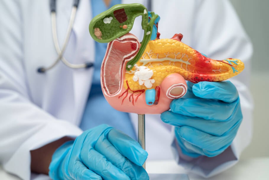 Pesquisadores identificam como o hábito de fumar acelera a progressão do câncer de pâncreas