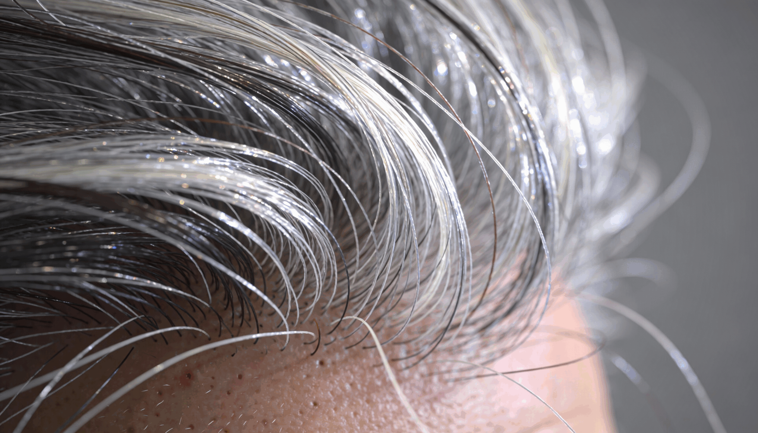 O embranquecimento dos cabelos ocorre por causa da diminuição progressiva de melanina