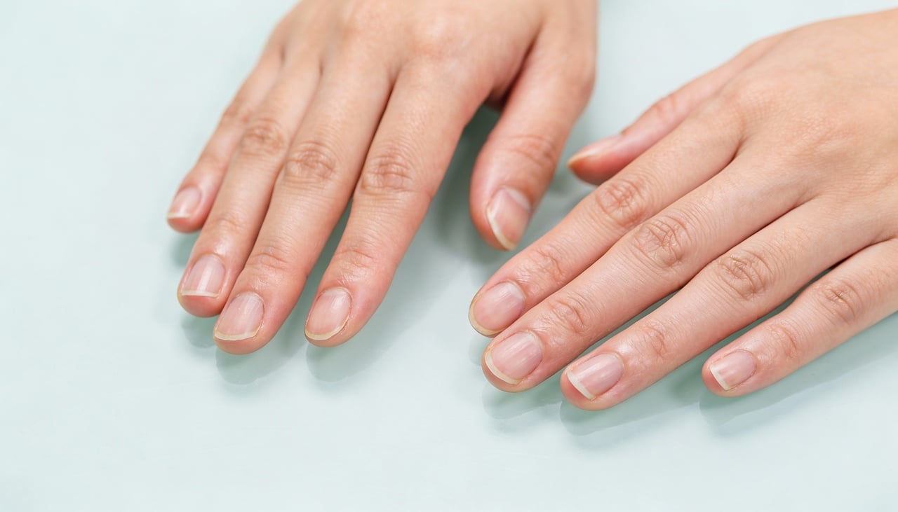 A região embaixo das unhas pode acumular sujeira, restos de produtos e micro-organismos que favorecem mau cheiro, manchas e infecções