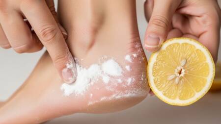 Como cuidar de "calcanhares rachados" para que fiquem macios e suaves novamente usando bicarbonato de sódio e limão; os resultados são incríveis