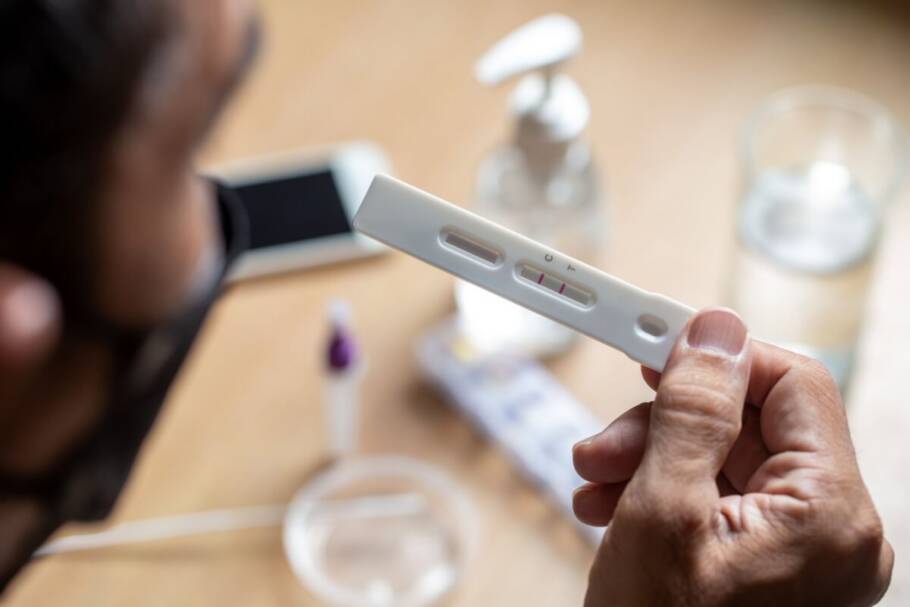 Exames fora do período indicado podem gerar resultados falso-negativos (Imagem: Anucha Naisuntorn | Shutterstock)