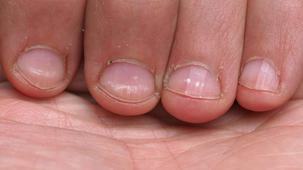 O erro comum de não ouvir a própria intuição pode custar sua paz. Veja como pequenas marcas nas unhas funcionam como lembretes para reorganizar sua vida agora.