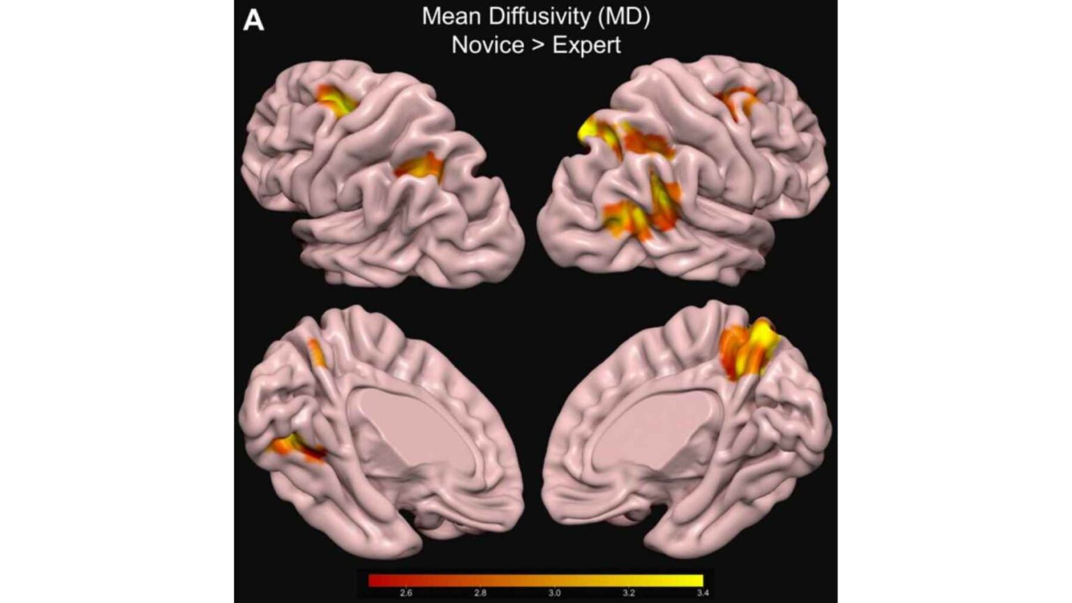 Exames de ressonância magnética destacam diferenças estruturais cerebrais entre observadores de aves especialistas e iniciantes, especialmente em redes de atenção.