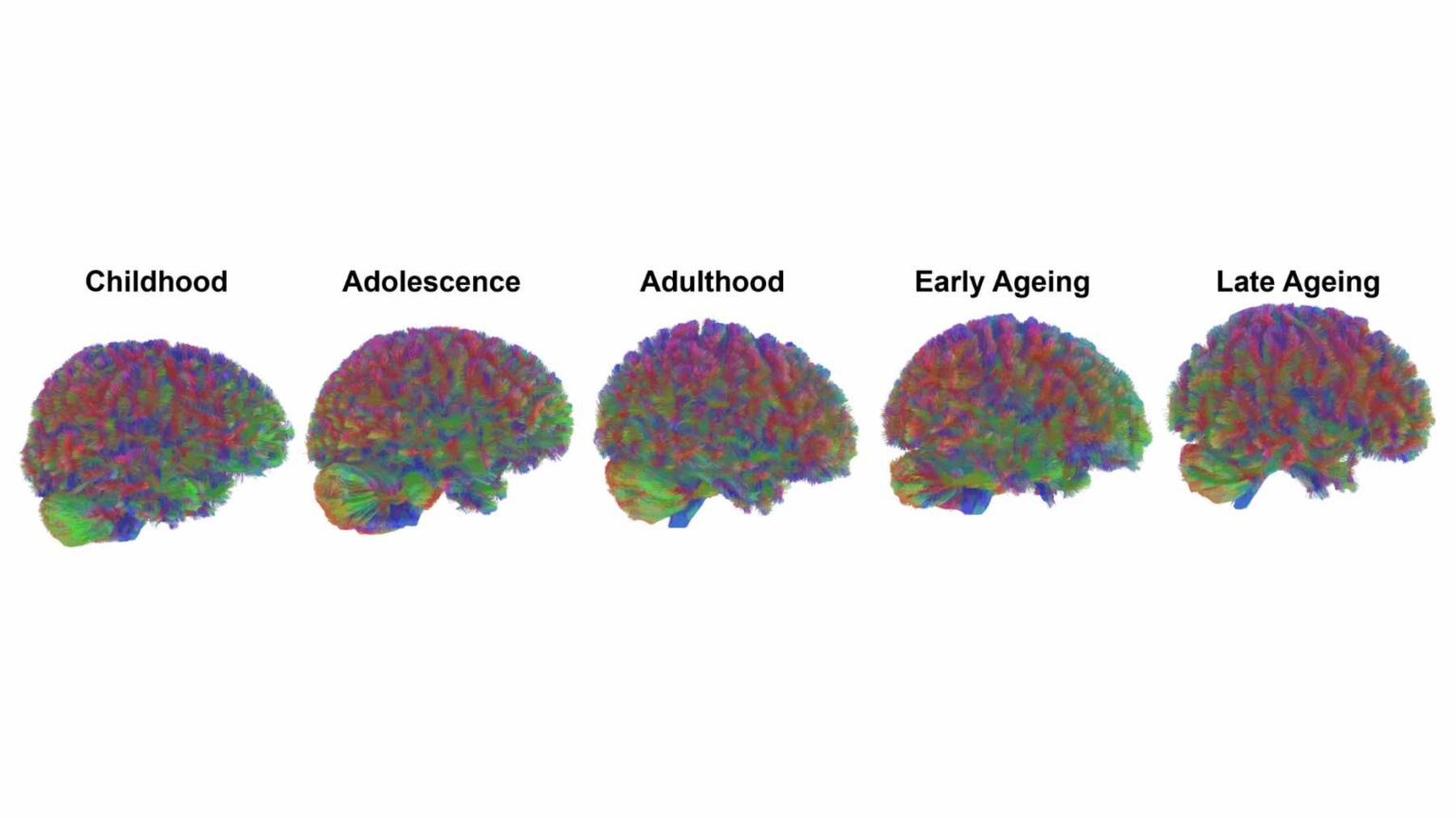 O novo trabalho se encaixa em um esforço crescente para mapear como o cérebro muda ao longo das décadas.