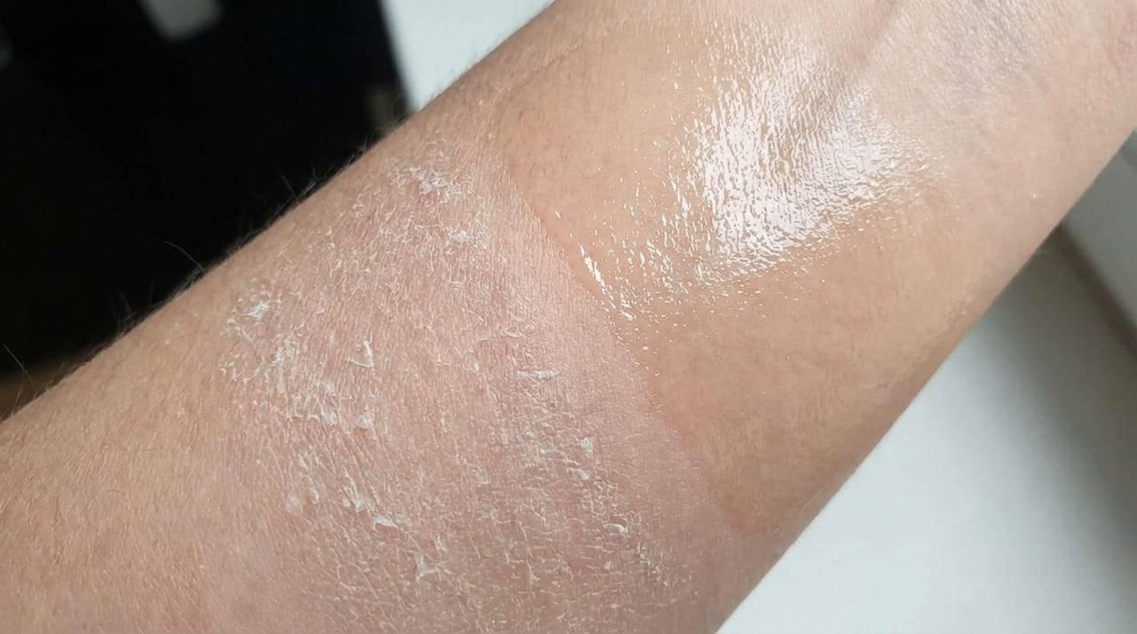 Aplicar óleos naturais logo após o banho sela a umidade e recupera a radiância da derme, combatendo o ressecamento de forma definitiva.