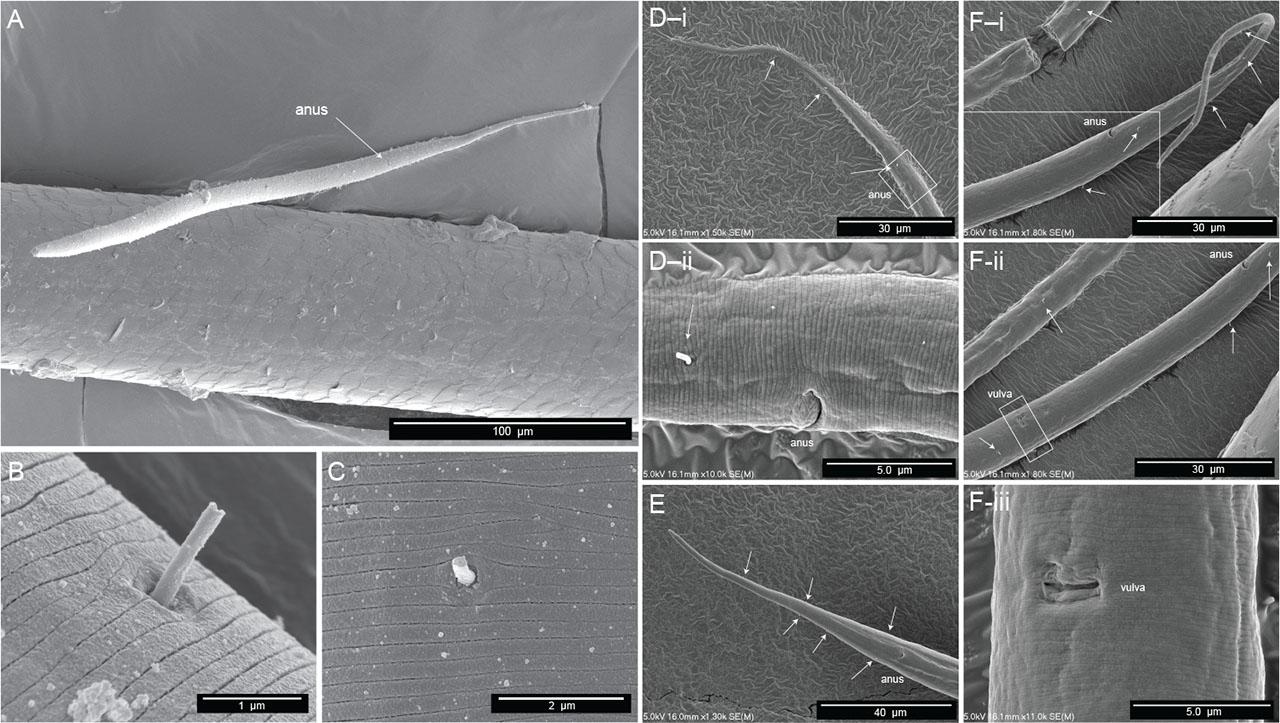 Microscopia eletrônica de varredura de fêmea Diplolaimelloides woaabi sp. nov. mostra várias características, incluindo o padrão posterior das papilas em (A) todo o corpo, (B,C) um close do tegumento e papila única, e (D–F) as extremidades posteriores dos nematoides, com cada letra mostrando um indivíduo diferente e imagens sucessivamente ampliadas do ânus e/ou das áreas da vulva com papilas visíveis marcadas com setas brancas.