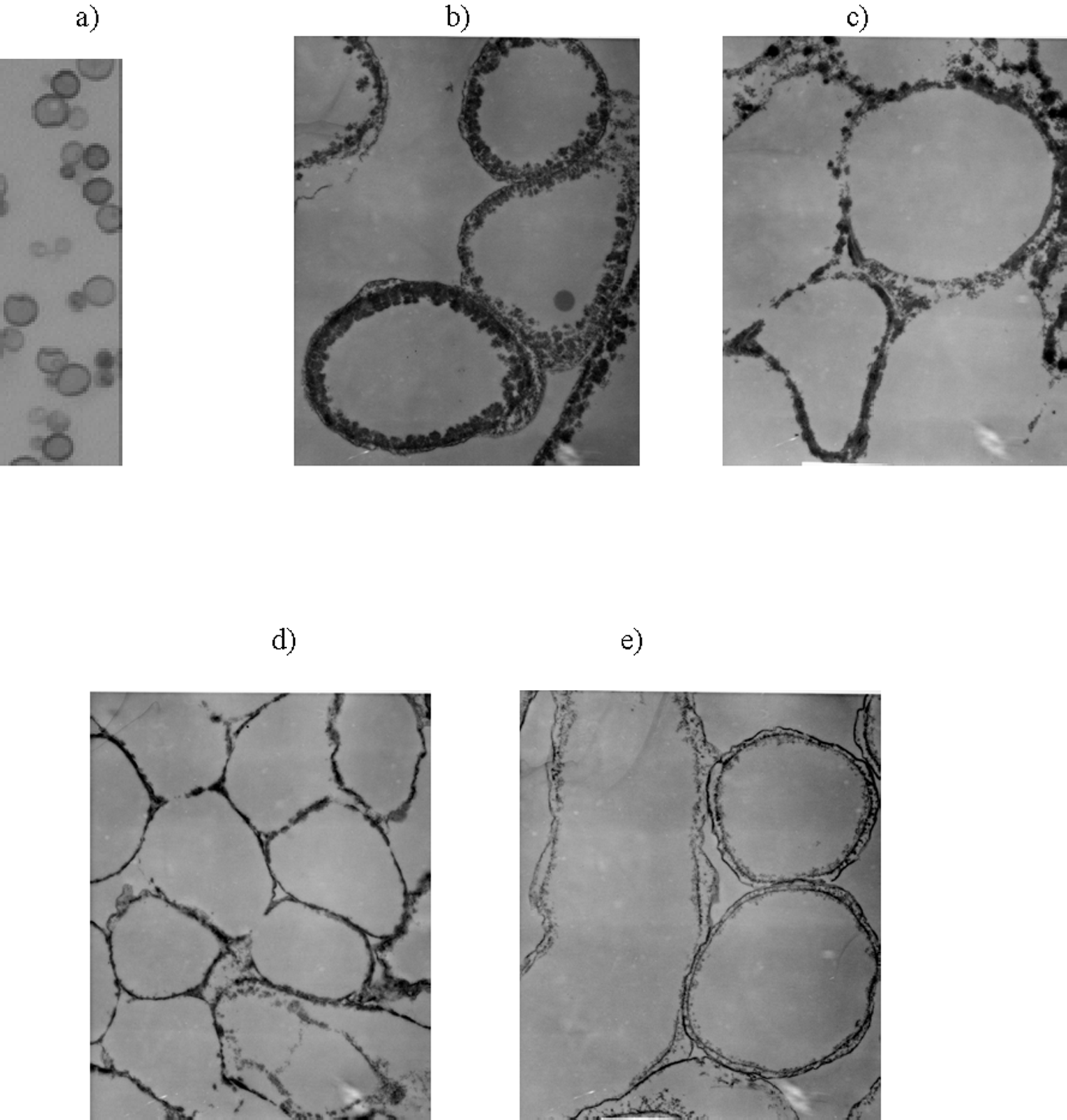 a) imagem de microscopia óptica dos “fantasmas” de melanina de C. neoformans; (b–e) Imagens TEM de “fantasmas” de C. sphaerospermum derivadas de células cultivadas em meios ricos ou deficientes em nutrientes: b) ágar de batata dextrose; c) ágar dextrose de Sabaroud; d) ágar aquático com caseína; e) ágar aquático com dextrose. Ampliação original: imagem de microscopia óptica – X 1.000; Imagens TEM – X 13.000.