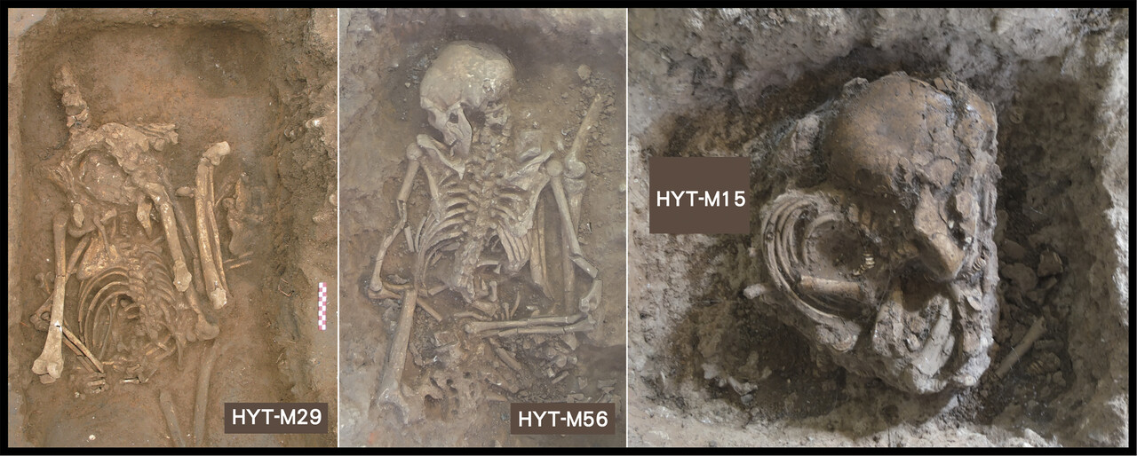 Exemplos de sepultamentos de Huiyaotian (HYT), Guangxi, no sul da China, anteriormente suspeitos de serem desmembrados. HYT-M29 (mulher adulta): o quadril e o joelho estão posicionados adjacentes um ao outro, uma orientação anatomicamente impossível. HYT-M56 (homem adulto): a coluna vertebral está voltada para cima, mas o quadril está em decúbito ventral, novamente uma orientação anatomicamente impossível. HYT-M15 (criança de 3 a 5 anos): ossos altamente compactados e agrupados.