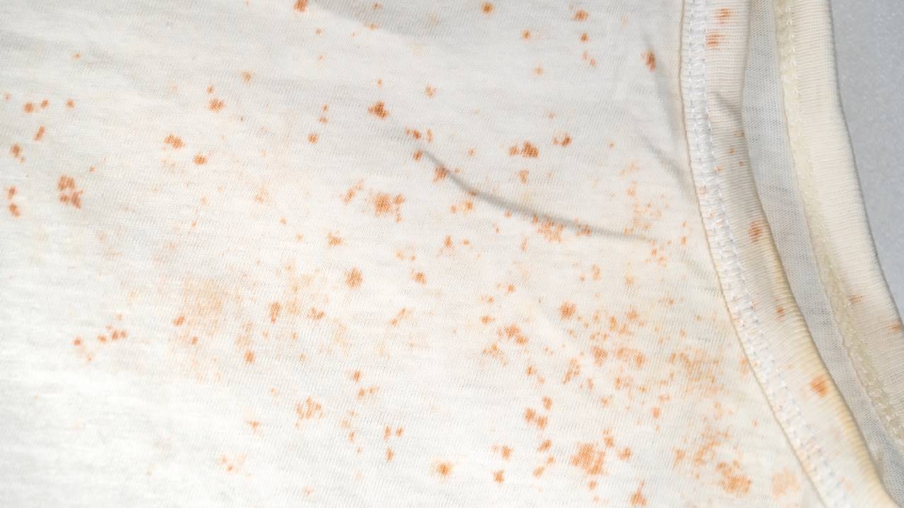 Roupas mofadas podem voltar ao normal com limpeza correta, ventilação e um truque simples contra umidade.