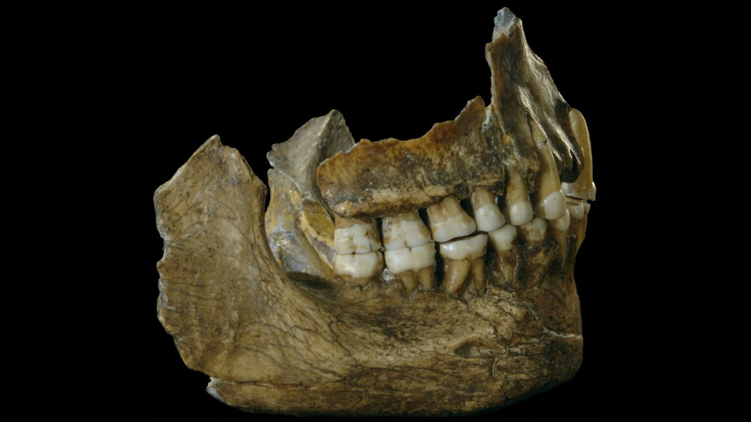 Uma dor de dente pode deixar você sem dormir. Agora imagine esse mesmo problema há cerca de 59.000 anos, sem anestesia e com uma caverna como uma “consulta” improvisada.