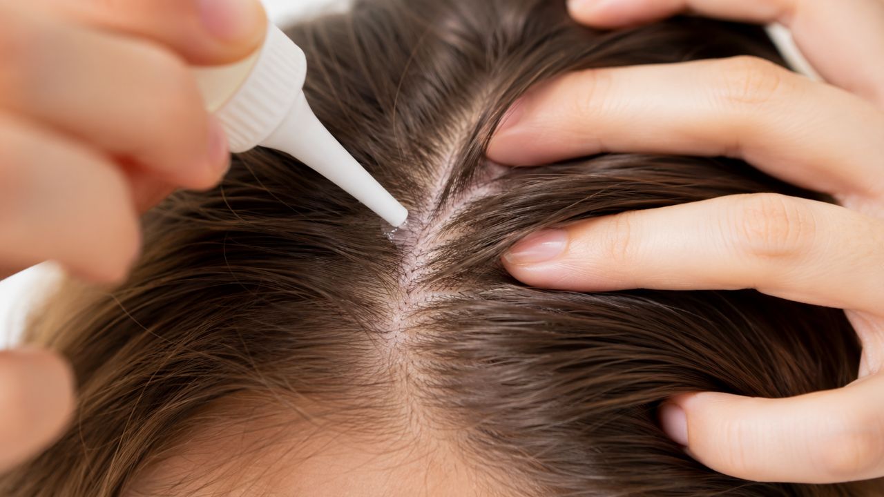 Aplique a mistura no couro cabeludo massageando, deixe agir por até 15 minutos e enxágue bem.