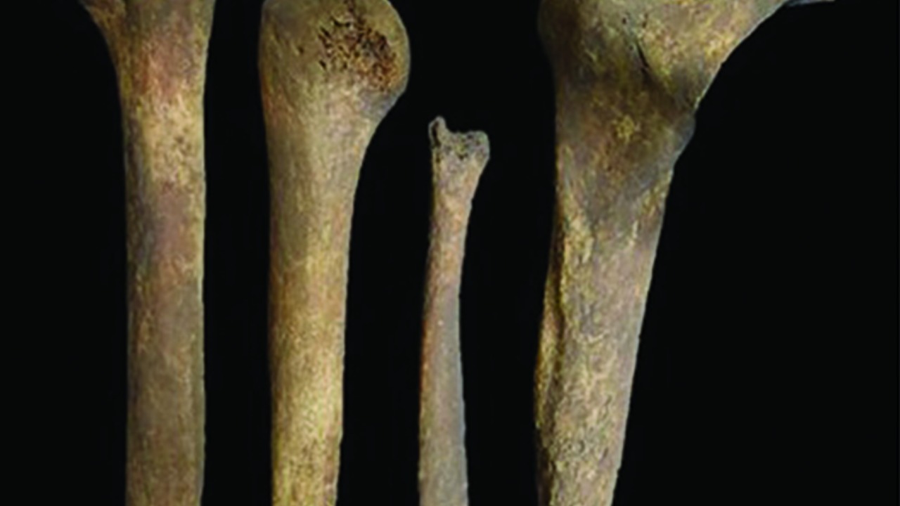 Ossos de mulher foram modificados e cuidadosamente recolocados na sepultura antiga.