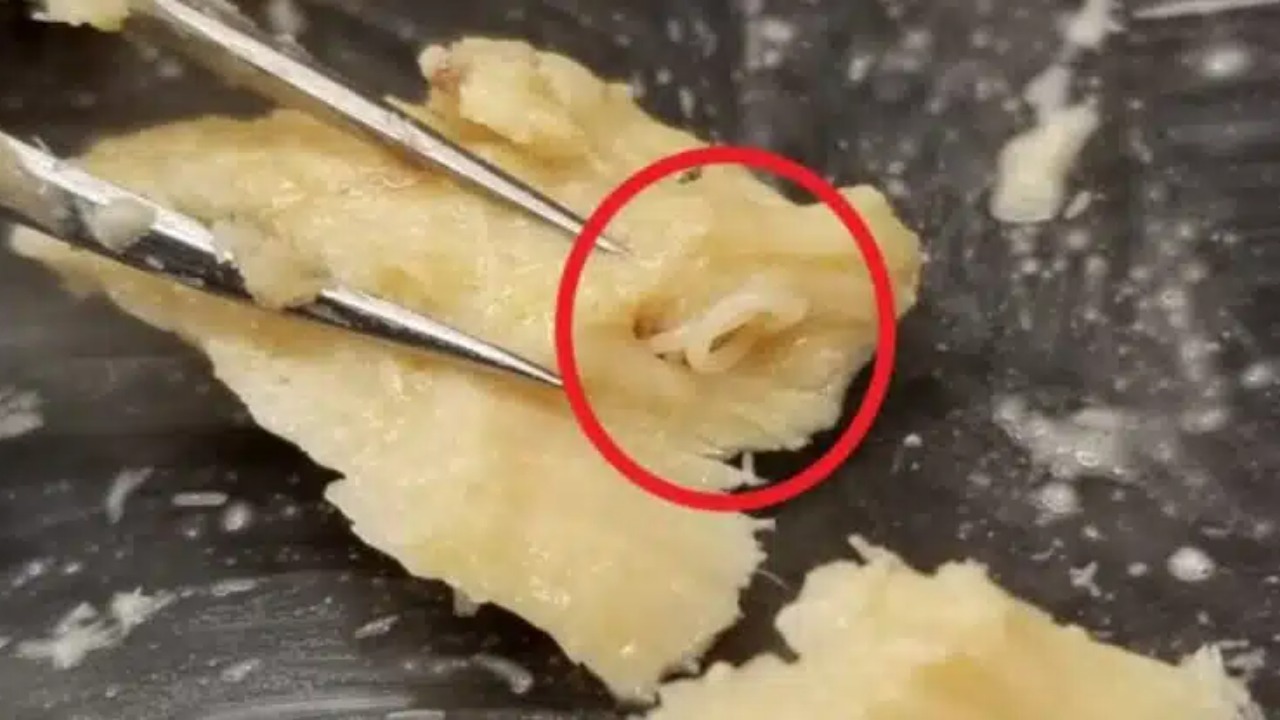 Pesquisadores analisam amostras guardadas e descobrem parasitas marinhos bem preservados.