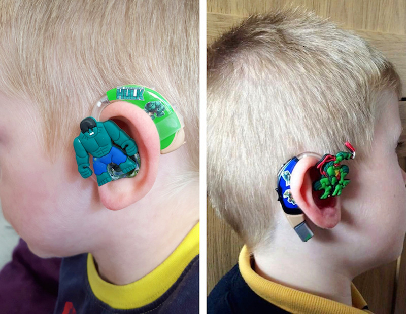 Menino usa aparelho auditivo decorado com enfeite criado por sua mãe