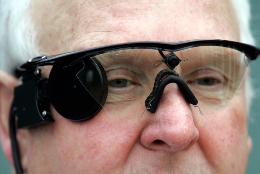 A pesquisa demonstrou a eficácia do implante biônico (Foto: Divulgação/Argus)