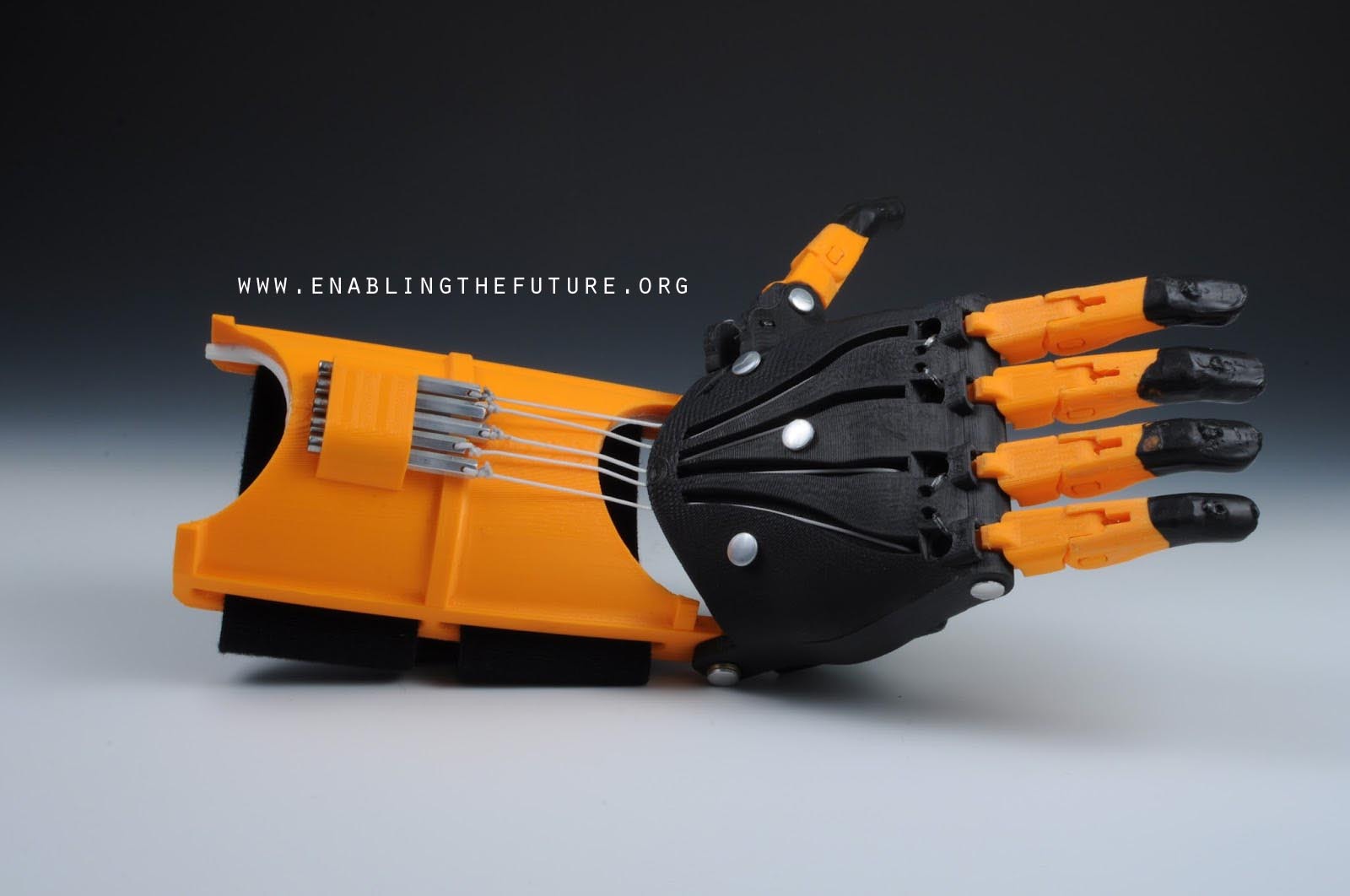 O menino francês recebeu a prótese impressa em 3D na semana passada