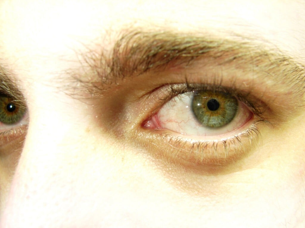 Cientistas desenvolvem equipamento para diagnosticar catarata