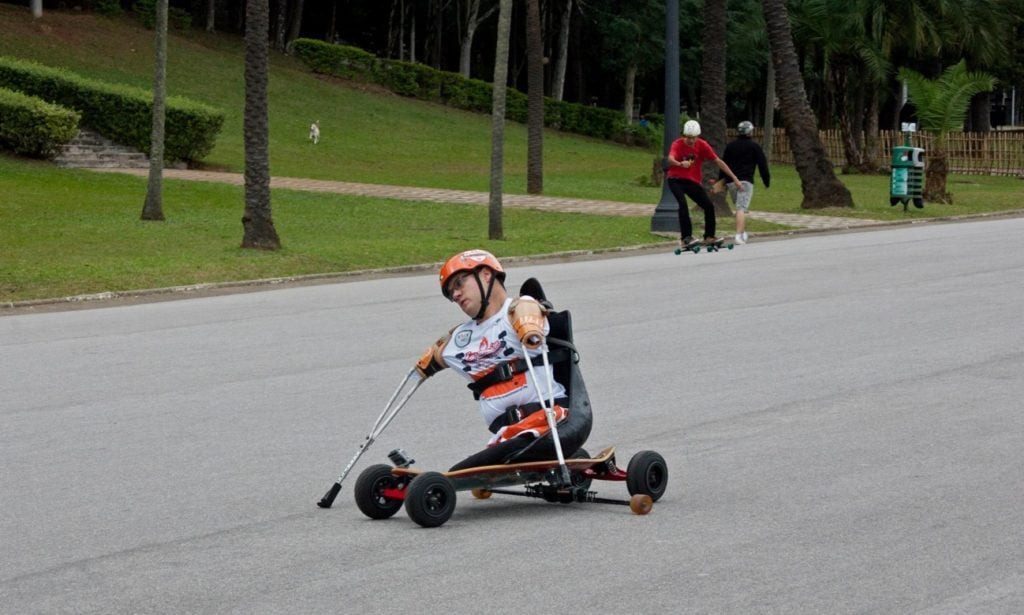 Marcos, que nasceu com a Sindrome de Hanhart