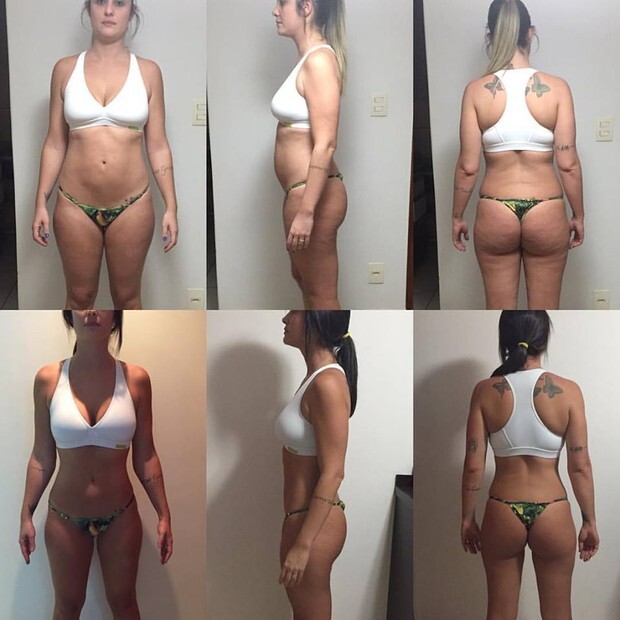 A dieta consiste na injeção de hormônio que “simula gravidez”